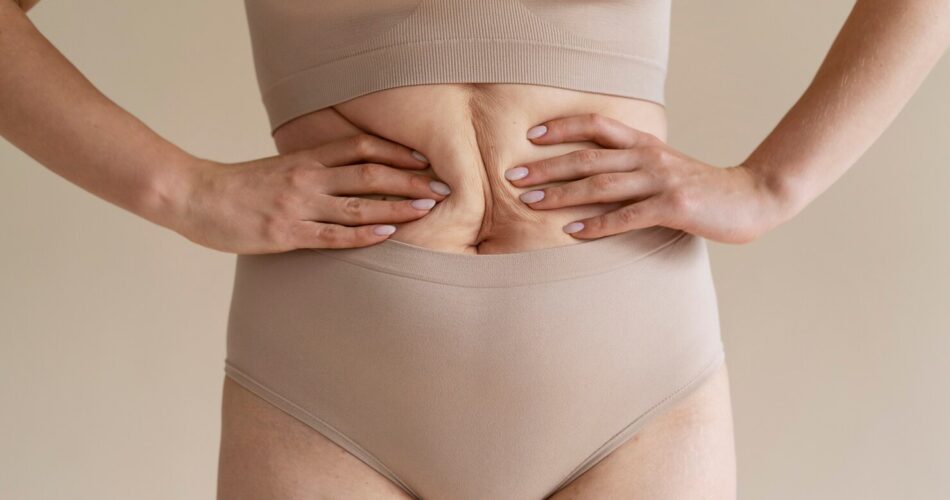 Как убрать живот после родов