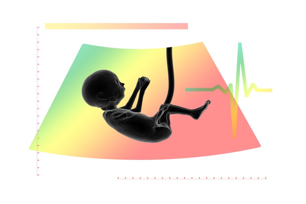 How to use the fetal Doppler How to use the fetal Doppler