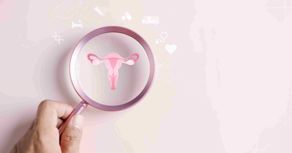 Эндометриоз у женщин после 50 лет