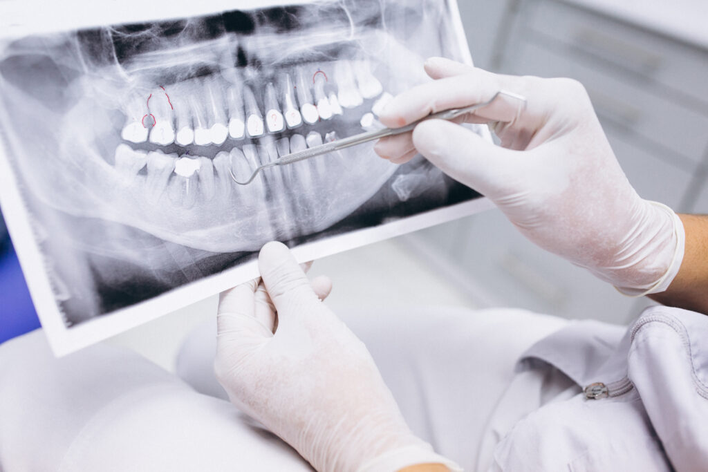 Teeth during pregnancy Photo1